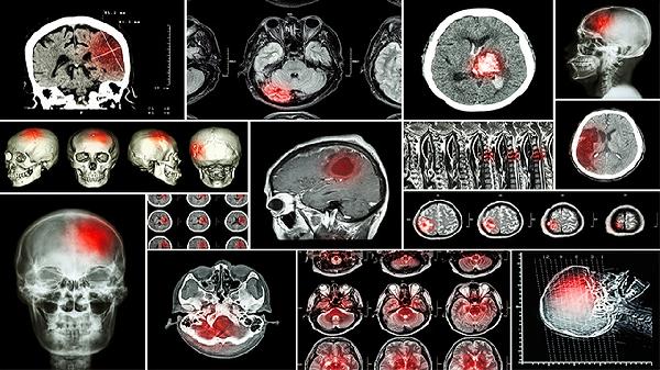 骑自行车有利于身心健康 至少给身体带来6大优点